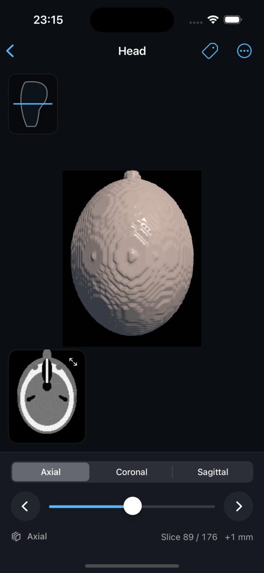 The current slice plane lifted into a 3D view