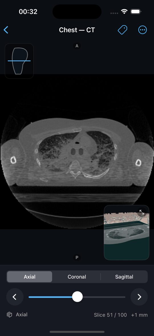Axial slice through the chest