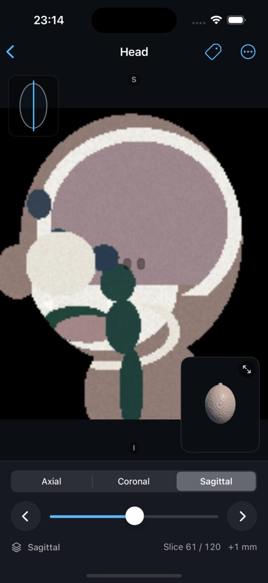 A sagittal slice through the head